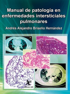 cover image of Manual de patología en enfermedades intersticiales pulmonares